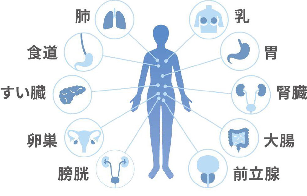 miSignal®(尿がん検査)検査可能な男女計10がん種